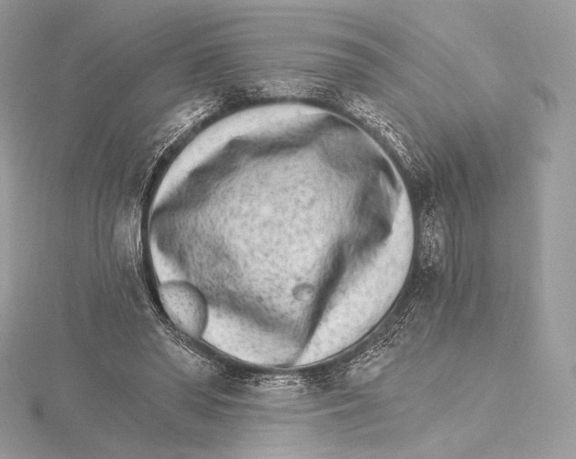 X0000115650398200912081129