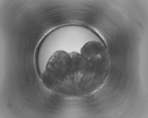 X0000115650835200912081123