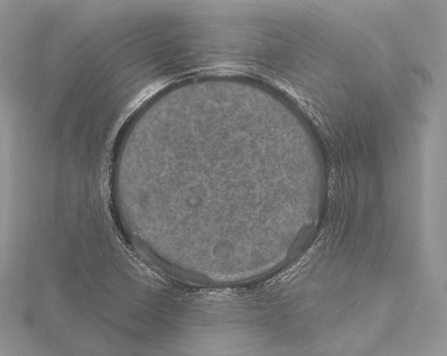 X0000115651410200912081115