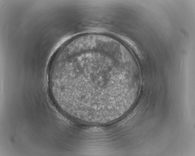 X0000115651414200912081115