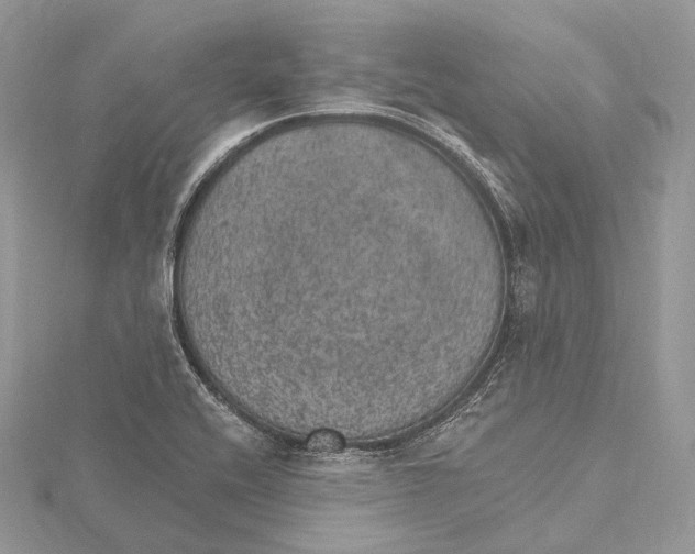 X0000115651416200912081115