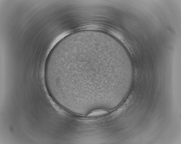 X0000115651426200912081115