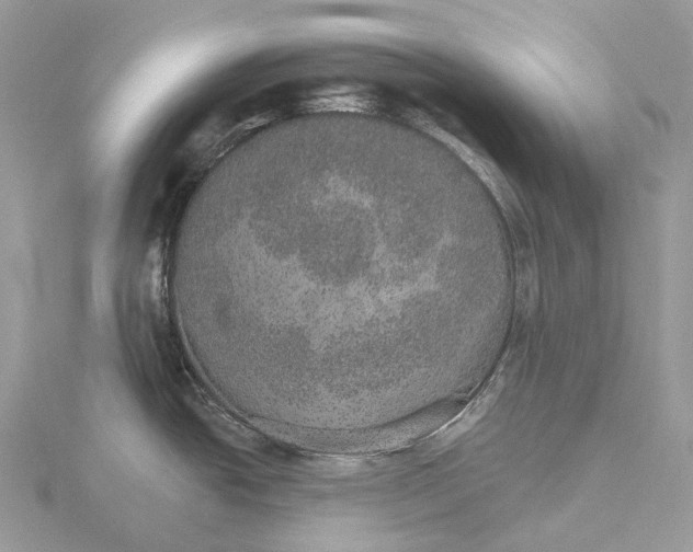 X0000115651438200912081116