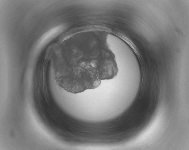 X0000115651439200912081116