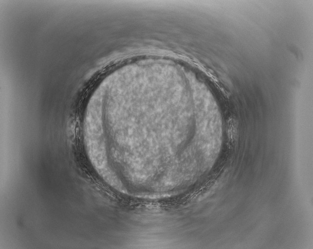 X0000115651495200912081114