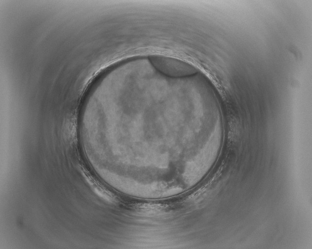 X0000115651499200912081114