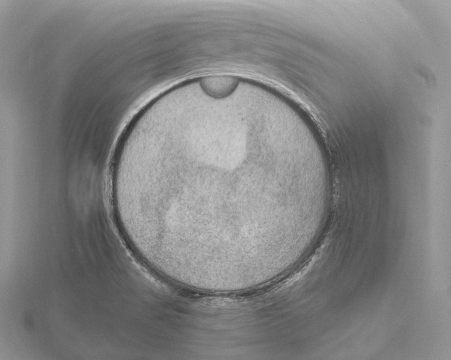 X0000115651517200912081114