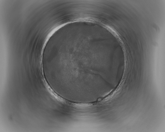 X0000115661200200911121207