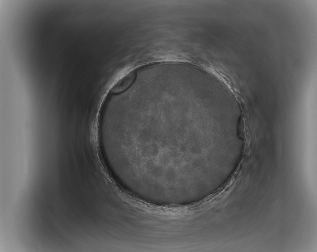 X0000115660008200911191014