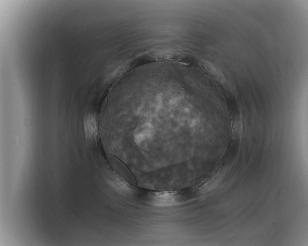 X0000115660335200911191010