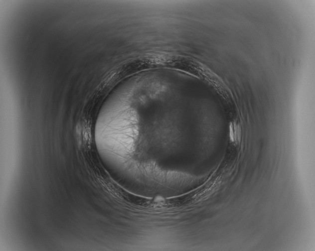 X0000115661155200911190959