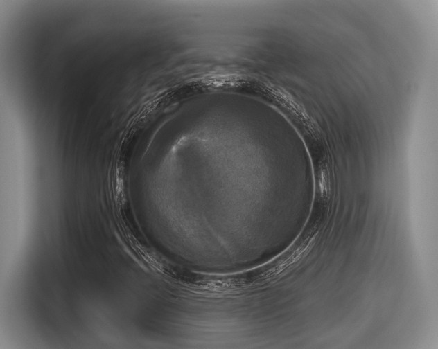X0000115661396200911190955