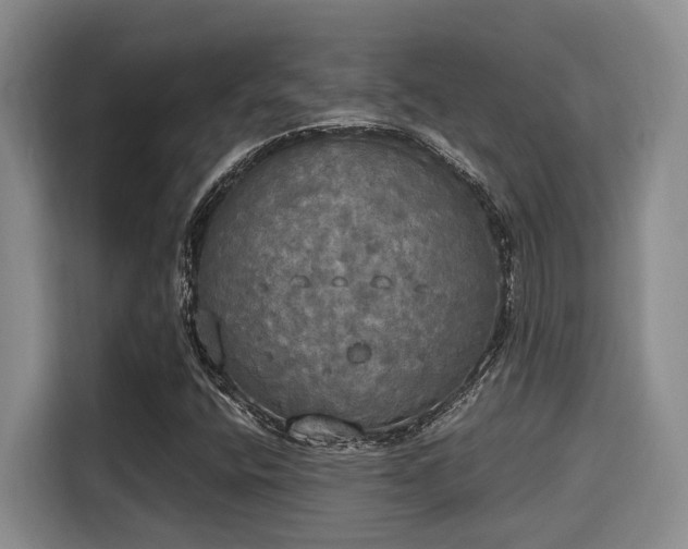 X0000115661400200911190955