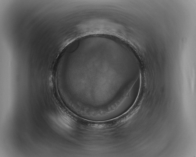 X0000115661497200911190954