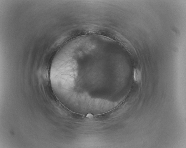 X0000115661155200911251704
