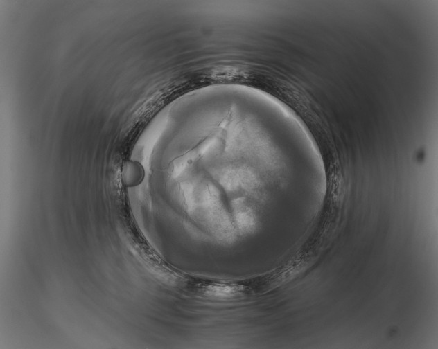 X0000115660375200912031338