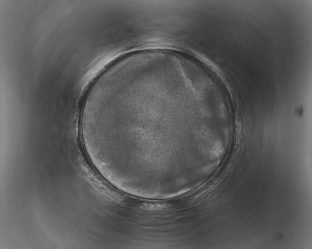 X0000115661415200912031322