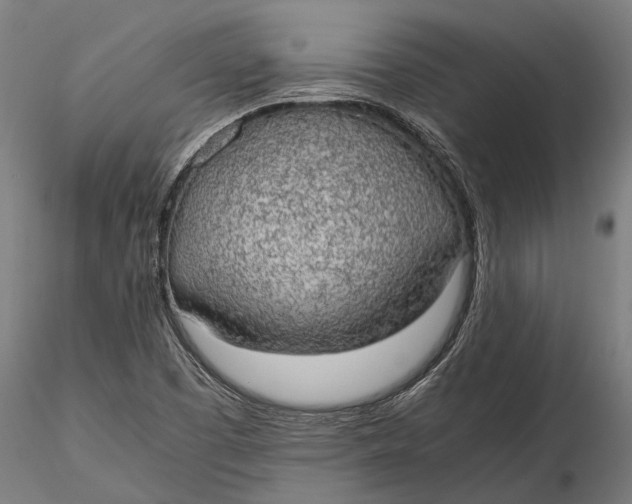 X0000115661457200912031321