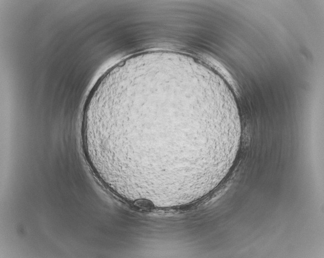 X0000115661146200912101046