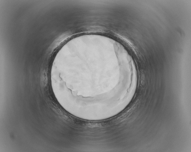 X0000115661407200912101042