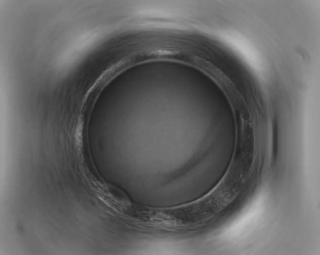 X0000115670387200911121157