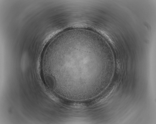 X0000115670487200911121156