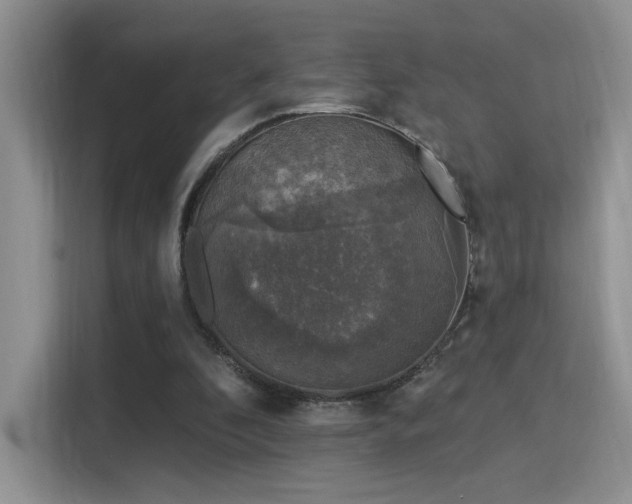 X0000115670296200911191031