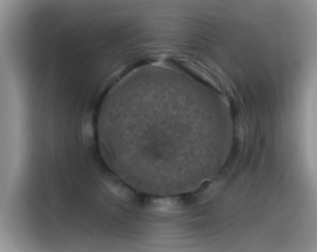 X0000115670516200911191028