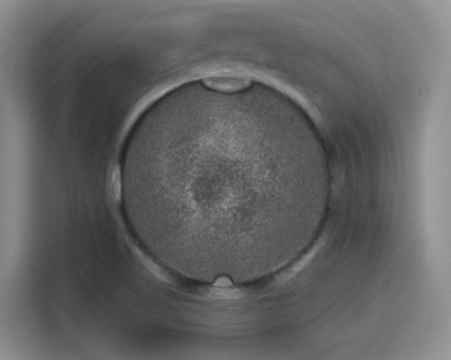 X0000115671509200911191015