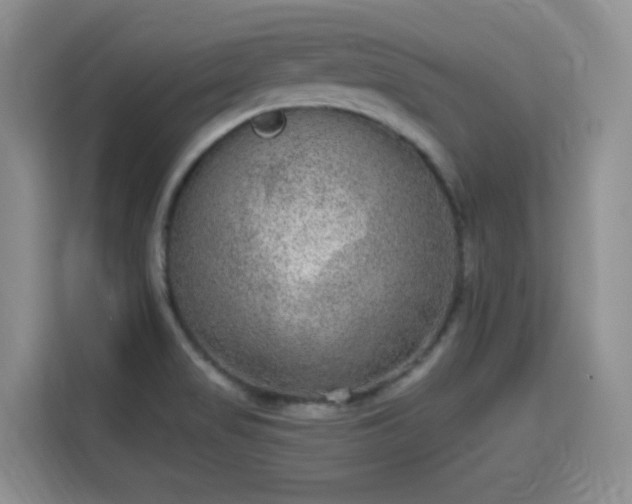 X0000115671517200911191015