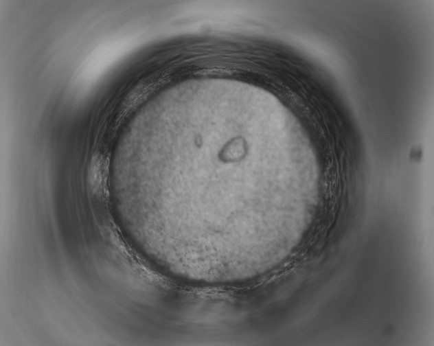 X0000115670146200912031404