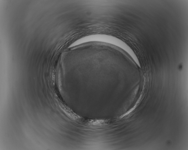 X0000115670186200912031405