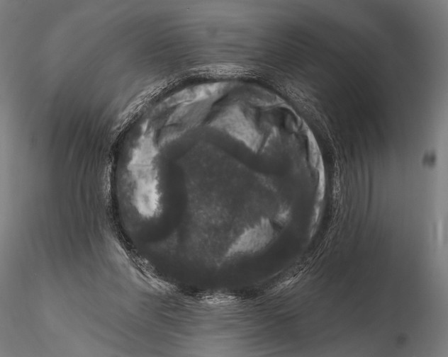 X0000115670206200912031404