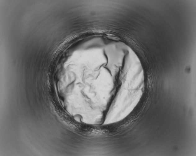 X0000115670256200912031403