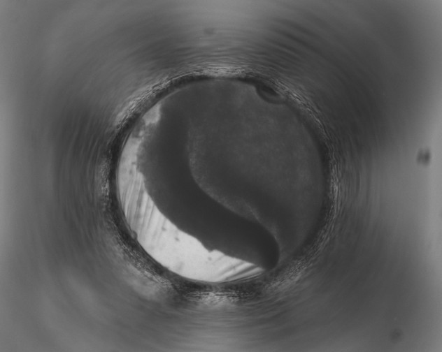 X0000115670303200912031402