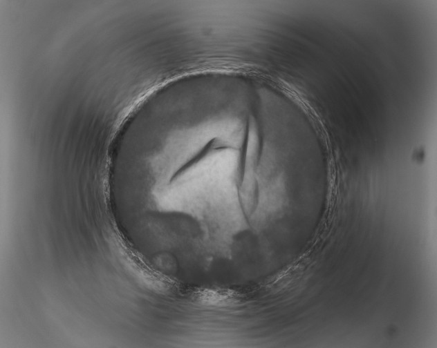 X0000115670346200912031401