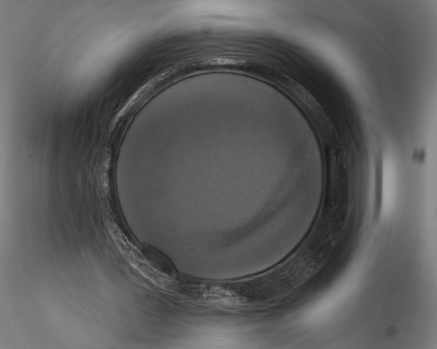 X0000115670387200912031401