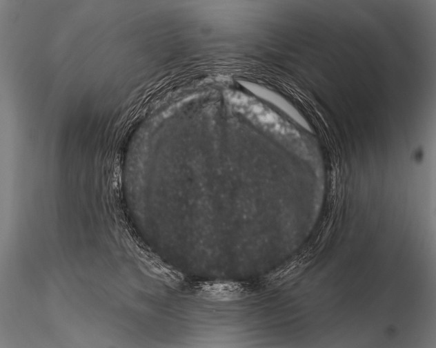 X0000115670517200912031359