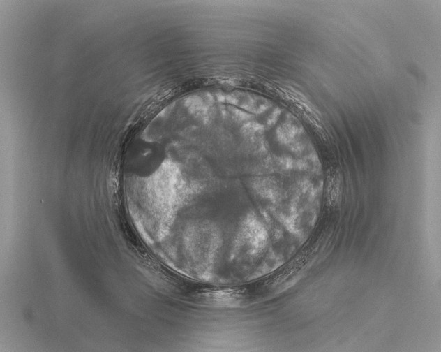 X0000115670365200912101117