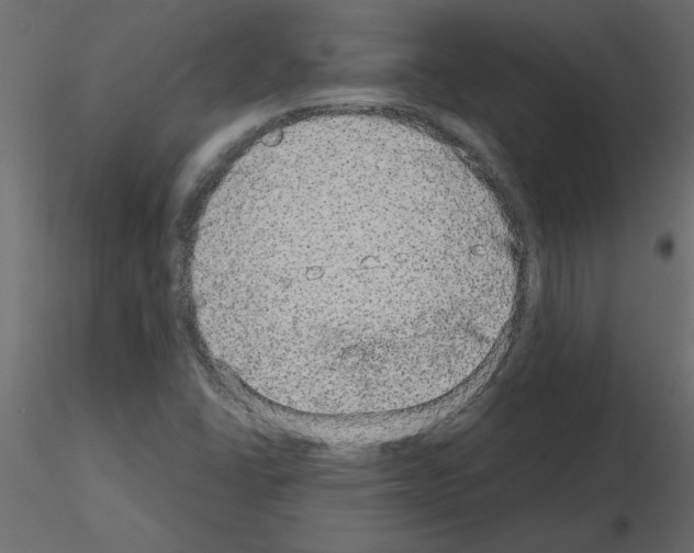 X0000115671406200912241410