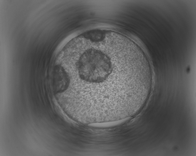 X0000115671436200912241410