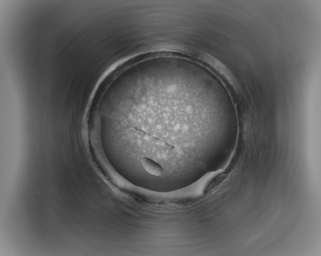 X0000115681024200911191049