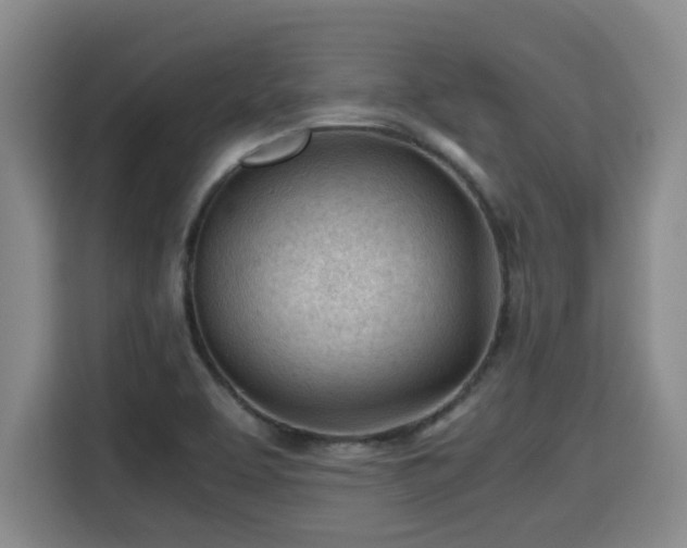 X0000115681463200911191044