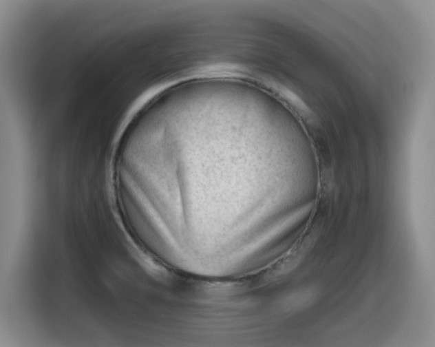 X0000115681470200911191044