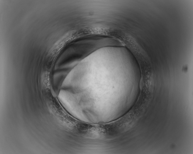 X0000115680696200912031420