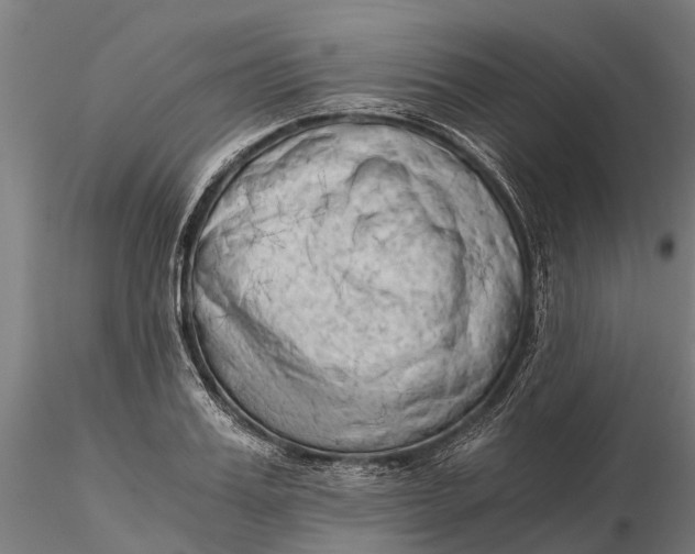 X0000115680987200912031415