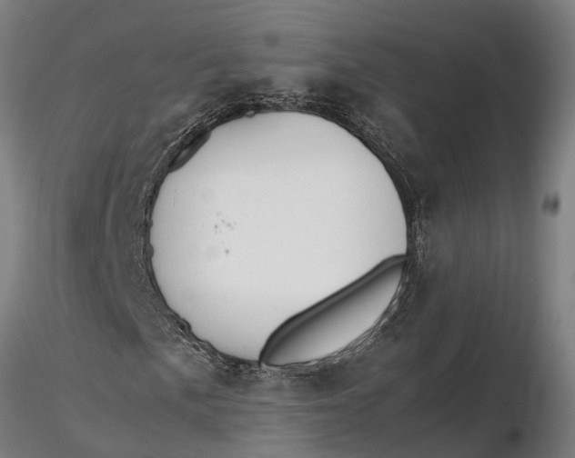 X0000115681057200912031414