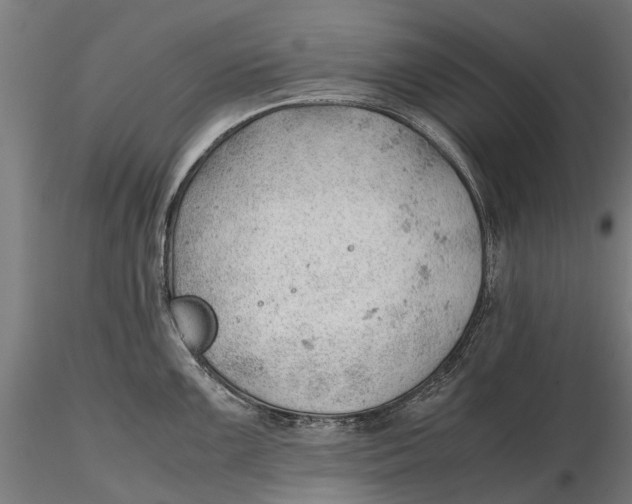 X0000115681099200912031413