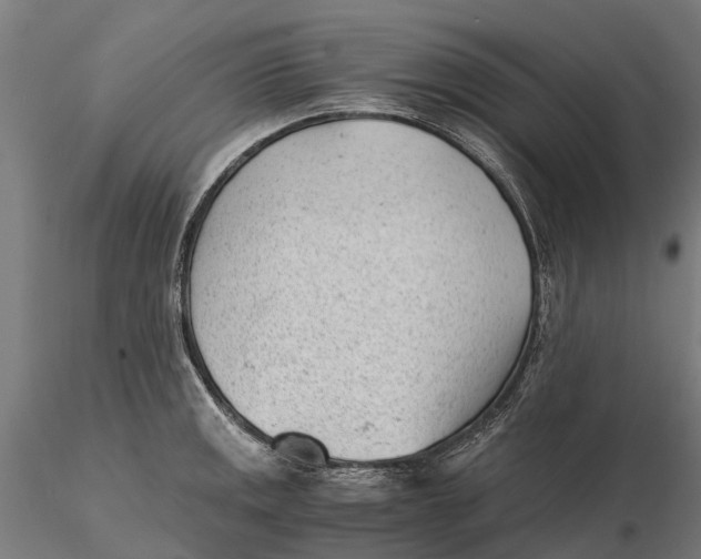 X0000115681141200912031413