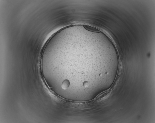 X0000115681149200912031413